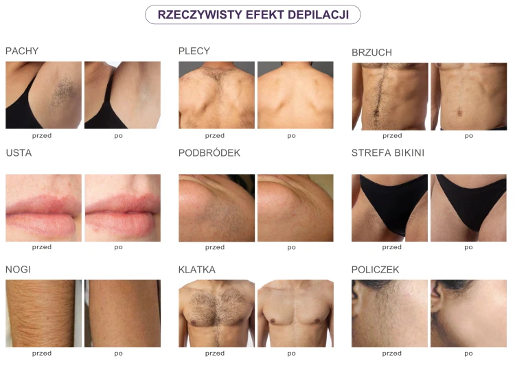 obraz_2024-11-17_132608177.png