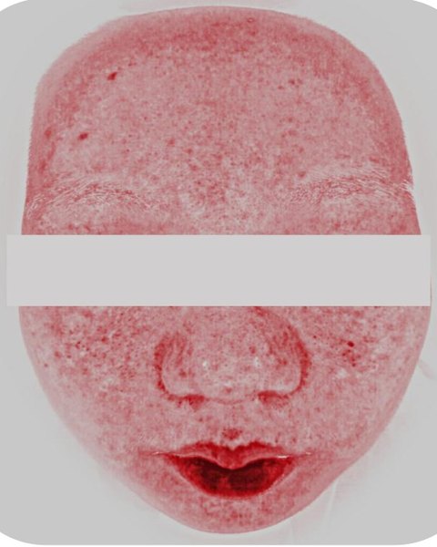 Mapa hemoglobiny w świetle czerwonym